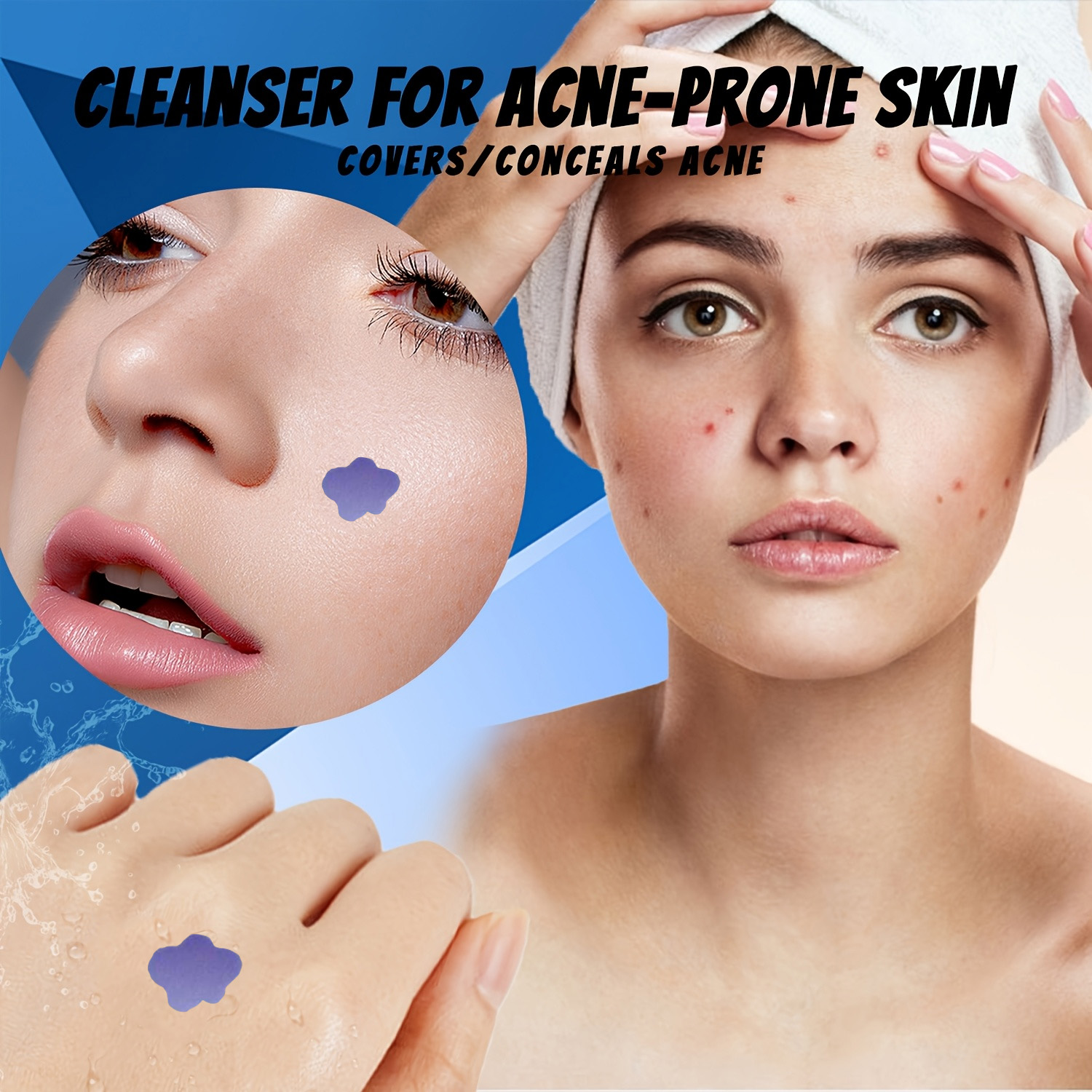 Mikronadel-Akne-Pflaster 232 S – Skincare Bewertung und Preis