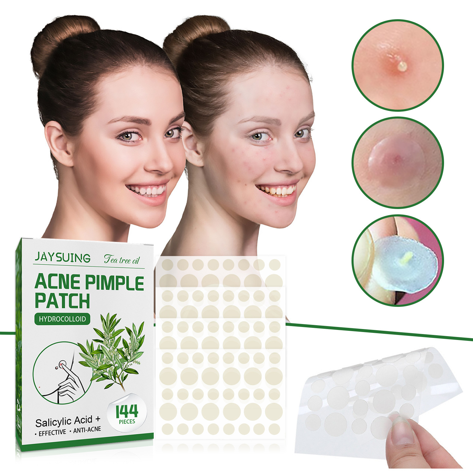 Hydrokolloid-Akne-Pflaster – a – Hydrocolloid Pimple Patch Bewertung und Preis